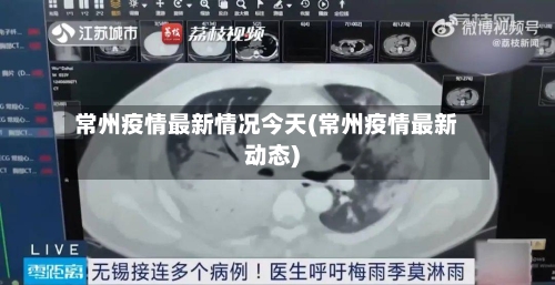 常州疫情最新情况今天(常州疫情最新动态)-第3张图片