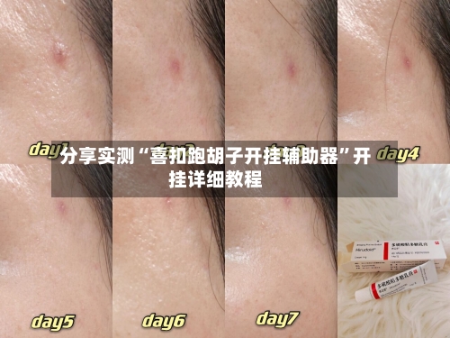 分享实测“喜扣跑胡子开挂辅助器”开挂详细教程